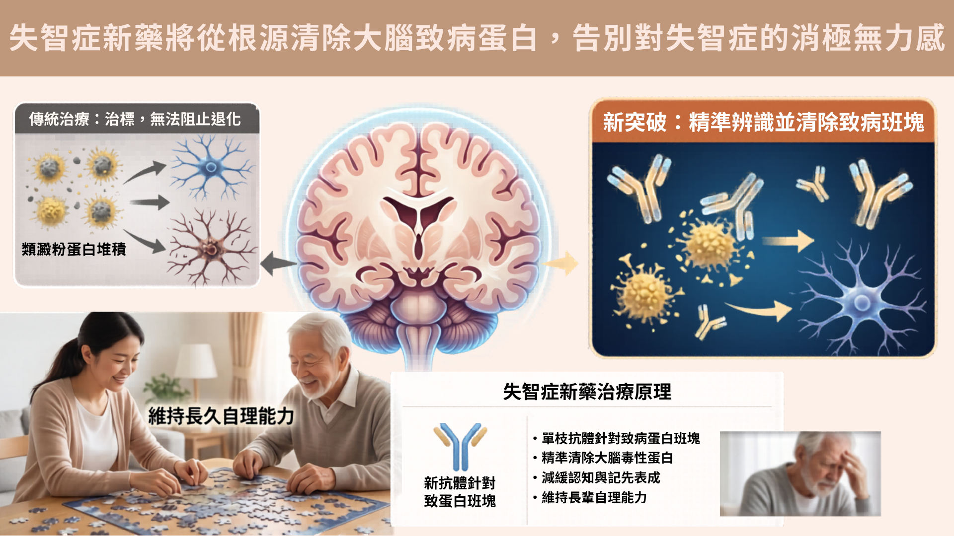 失智症新藥